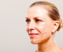dott-luca-rovati-trattamento-facelift-milano