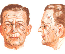 dott-luca-rovati-tumori-cutanei-milano